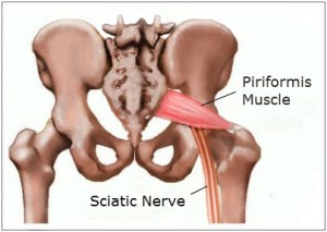 Source: http://piriformissyndrome.me/